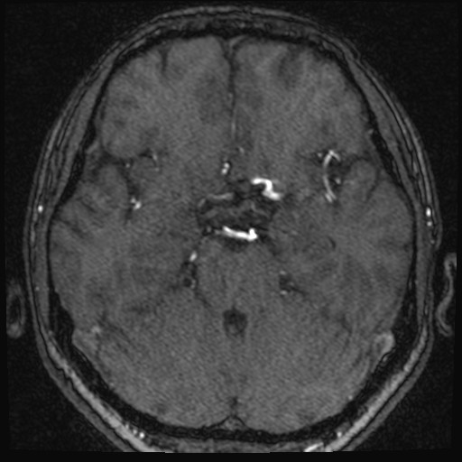 Click on the Serie image to view the images of VILLANUEVA, WILLIAM A.